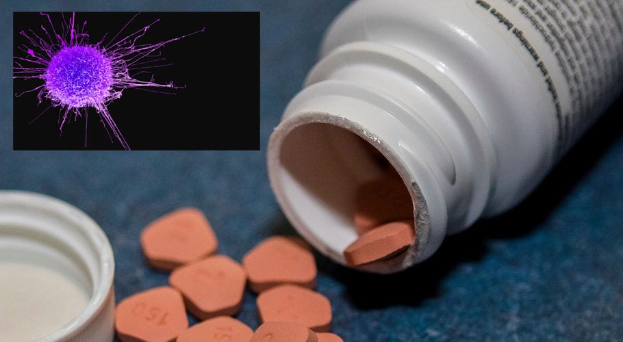تیزابیت کم کرنے کے لیے دوا کا مسلسل استعمال معدے کے کینسر کا باعث ہے۔محققین