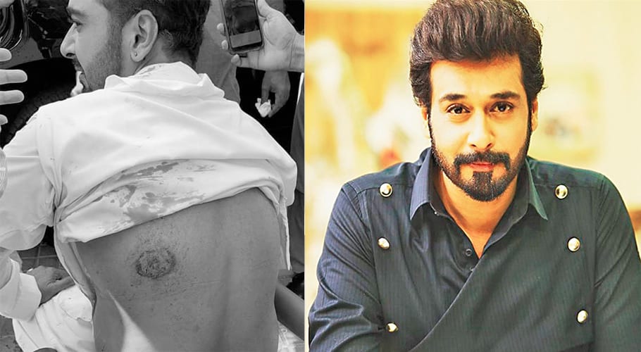 faisal qureshi injured