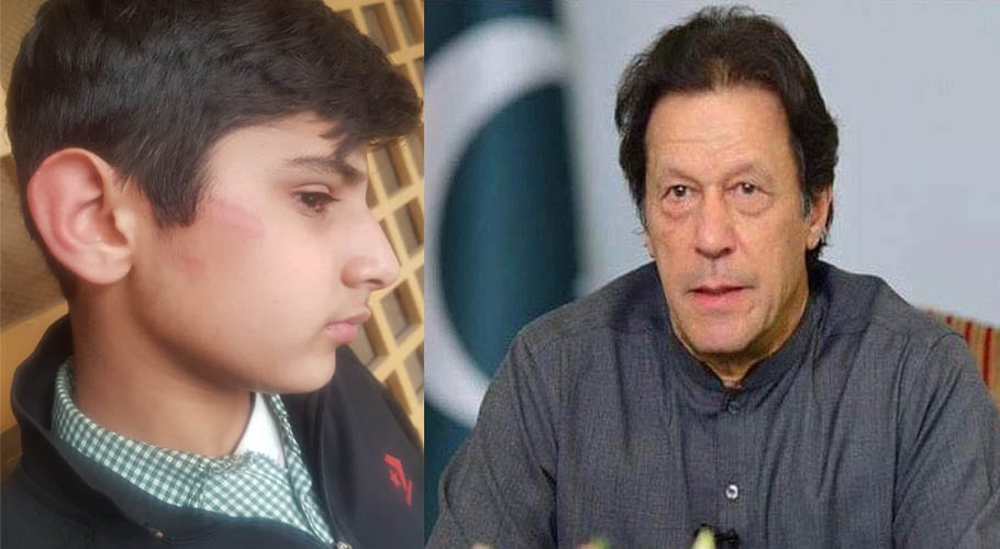 پولیس اہلکار کے بیٹے پر اسکول پرنسپل کا تشدد، وزیر اعظم کو شکایت ارسال