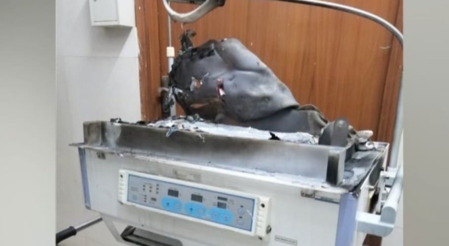 incubator caught fire