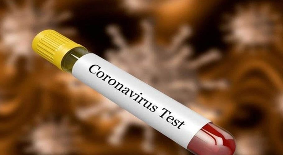 Corona revealed in test reports for died patient