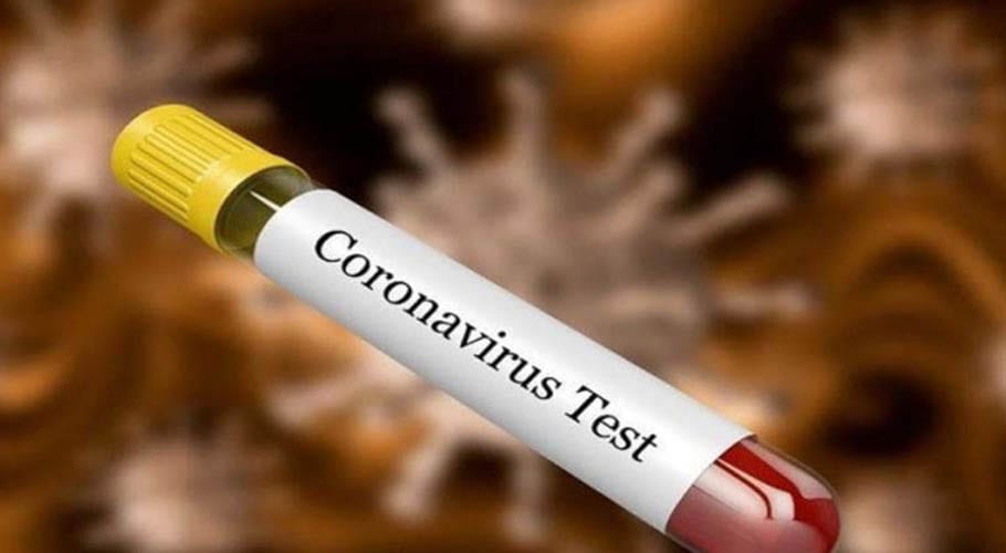 پاکستان میں کورونا وائرس سے57 ہزار 705 افراد متاثر، 1 ہزار 197 جاں بحق