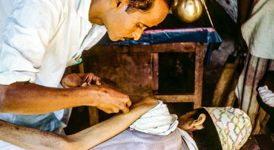 خطرناک بیماری اسمال پوکس کی علامات، تشخیص اور علاج