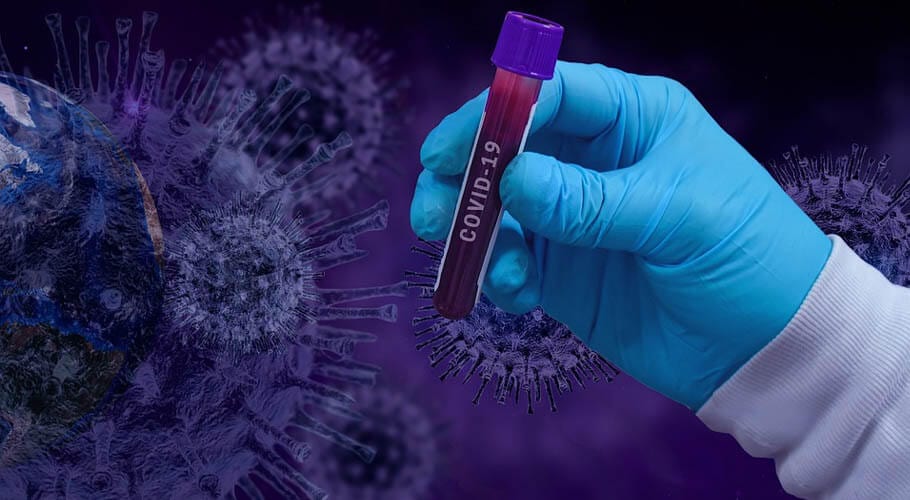 Pakistan reports 78 deaths by coronavirus