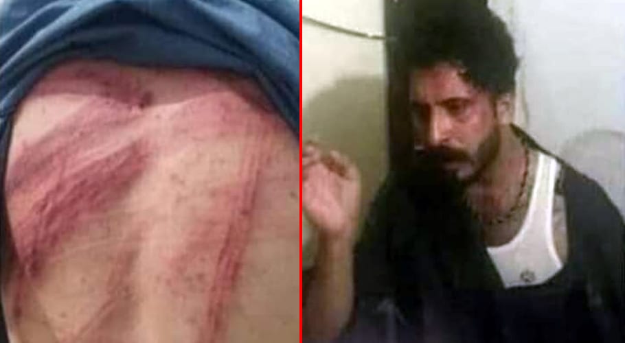 Peshawar police torture young boy