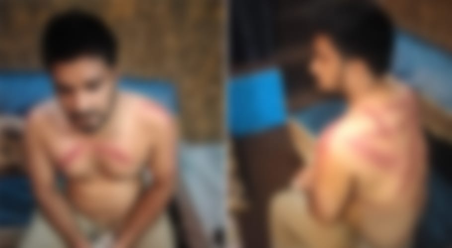 ایس ایچ او تھانہ ساندہ کایتیم نوجوان پر بدترین تشدد، جھوٹا مقدمہ بھی درج