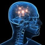مرگی سے بچاؤ کیلئے پاکستان میں برین پیس میکر ڈیوائس لگانے کا عمل شروع