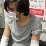 معروف صحافی اسد طورپر حملہ کرنے والے 3 افراد گرفتار ہو گئے، ذرائع