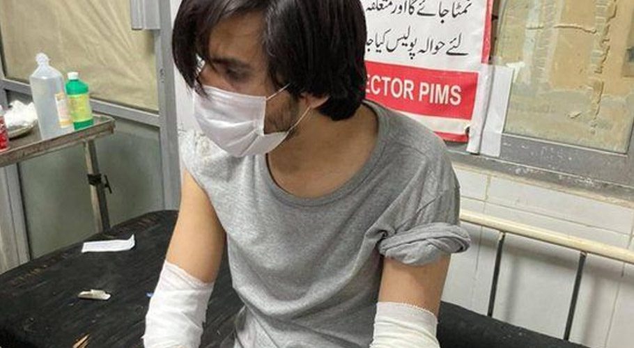 معروف صحافی اسد طورپر حملہ کرنے والے 3 افراد گرفتار ہو گئے، ذرائع