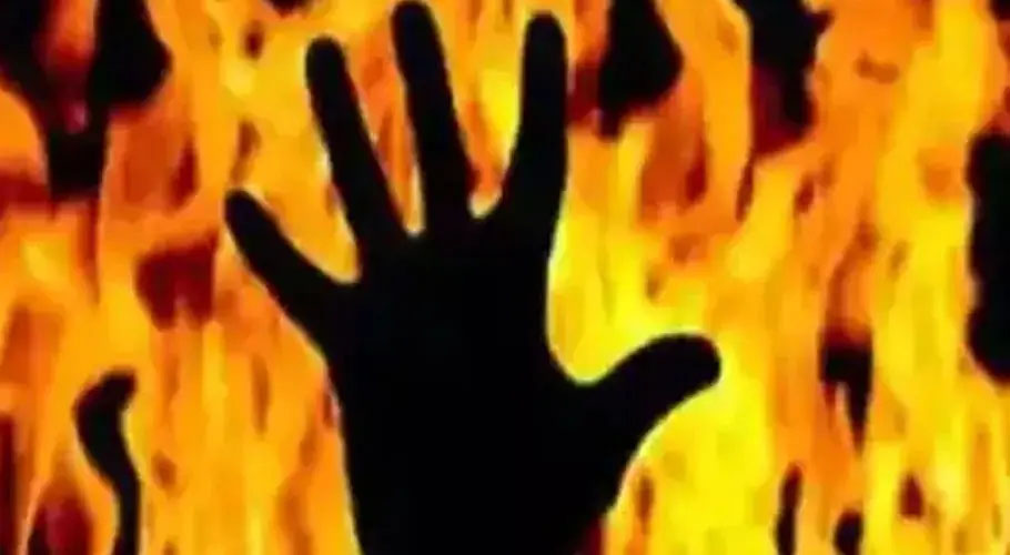 کراچی، ناظم آباد نمبر 3 میں آتشزدگی، گاڑی جل کر راکھ ہوگئی