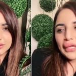 ایف آئی اے کا خوف، ادھوری سرجری، حریم شاہ کا چہرابگڑ گیا