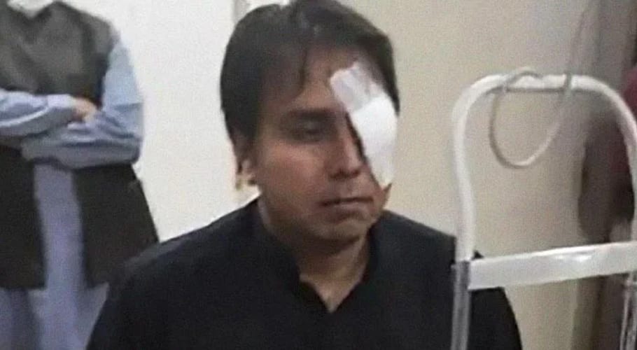 اللہ کے کرم اور قوم کی دعا سے بچ گیا، مارنے کی کوئی کثر نہیں چھوڑی تھی، شہباز گل