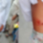 لیاقت اشرف کالونی میں آوارہ کتوں کے حملے میں دو بچے شدید زخمی