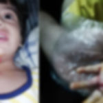 راولپنڈی کی گلیوں میں آوارہ کتوں کا راج، معصوم بچی شدید زخمی