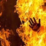 کراچی، شوہر نے بیوی کو گرم پانی میں اُبال دیا، مقدمہ درج