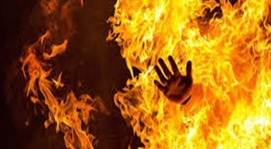 کراچی، شوہر نے بیوی کو گرم پانی میں اُبال دیا، مقدمہ درج