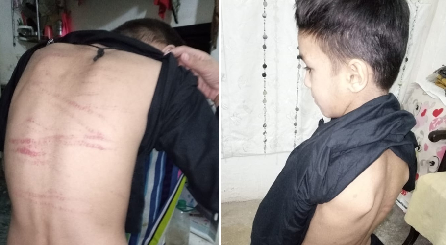 معلم کے بدترین تشدد سے بچے لہو لہان ہو گئے