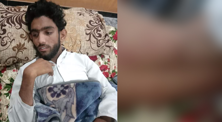 دینی مدرسے کے طالب علم پر وحشیانہ تشدد، کندھا فریکچر ہونے کا خدشہ