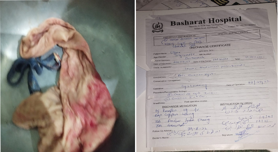 بشارت ہسپتال میں انتظامیہ کی نااہلی، دورانِ آپریشن مریضہ کے پیٹ میں تولیہ اور بیلٹ چھوڑدیا