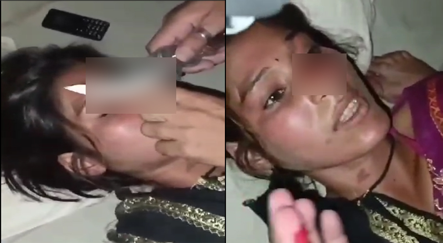 Man cuts off girl’s nose for declining friendship in DG Khan