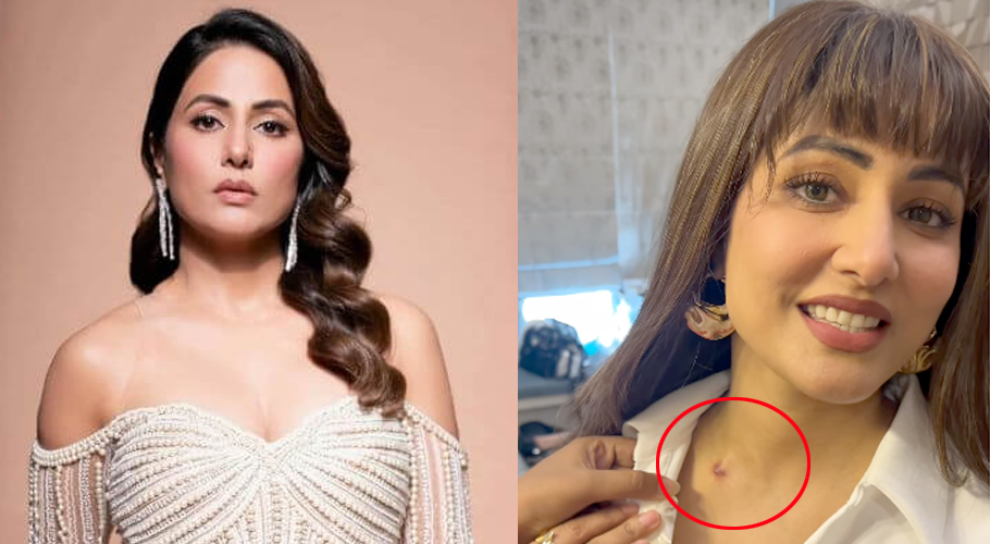 Hina Khan's first work assignment after diagnosis breast cancer