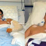 APS Attack Survivor Reveals