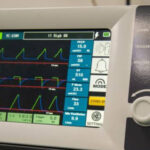 Pakistan launches first locally made ventilator