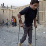 Another polio case detected in Sindh’s Badin district