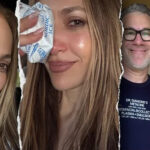 Jennifer Lopez suffers facial injury during rehearsals