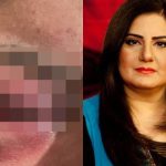 Jasmeen Manzoor shares evidence of domestic abuse