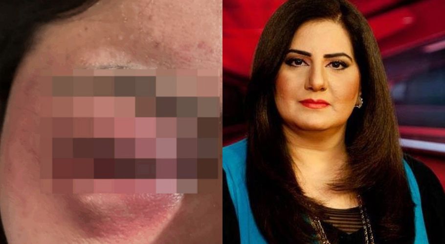 Jasmeen Manzoor shares evidence of domestic abuse