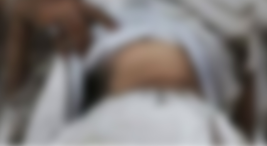 Man lured with job offer loses kidney to organ trafficking gang