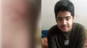 Karachi Madrassa Teacher Brutally Tortures Student; Parents Threatened with Serious Consequences