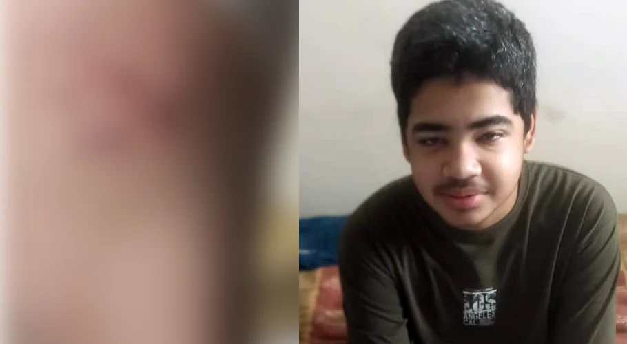 Karachi Madrassa Teacher Brutally Tortures Student; Parents Threatened with Serious Consequences