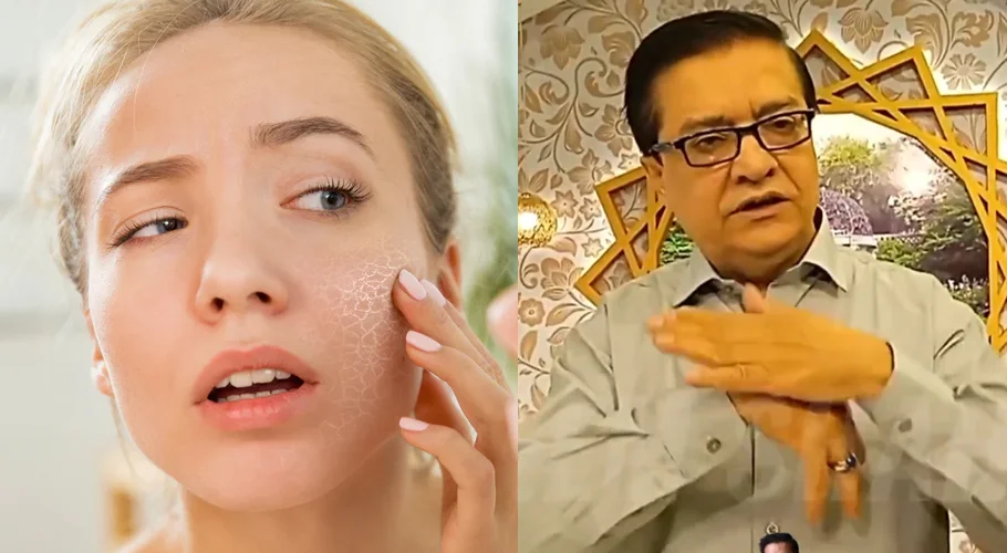 Homemade Moisturizing Cream for Dry Skin by Hakeem Shah Nazeer