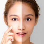 Natural Skin Whitening and Collagen Boosting Remedy
