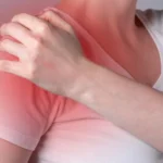 Arthritis Symptoms & Treatment