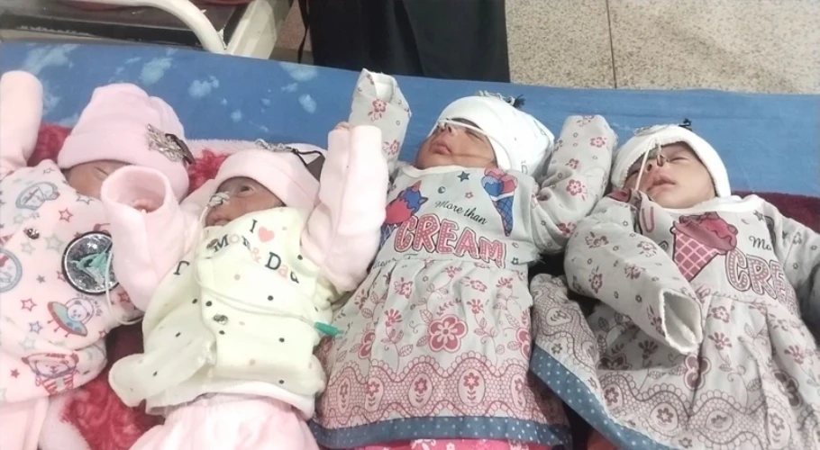 چار بچوں کی پیدائش